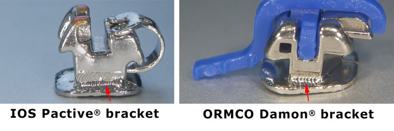 Best orthodontic self ligating bracket Pactive