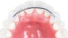 Picture of Lingual Retainers 3& 3 Kit - Kit