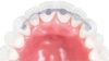 Picture of Lingual Retainers 3To 3 34 mm Upper Size - PK/2